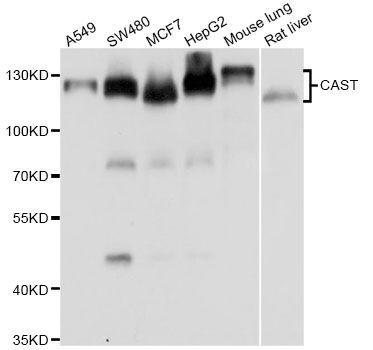 Western blot - [KO Validated] CAST Polyclonal Antibody (144-07634)