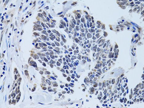 Immunohistochemistry - SIN3A antibody (144-60522)