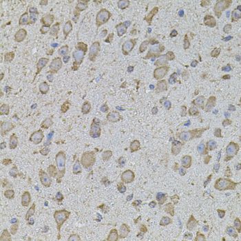 Immunohistochemistry - COL1A2 antibody (144-05786)