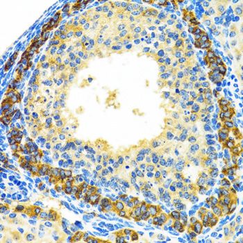 Immunohistochemistry - MRPL28 Polyclonal Antibody (144-05897)