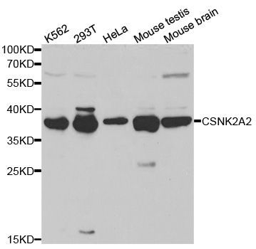 Western blot - CSNK2A2 Polyclonal Antibody (144-01616)