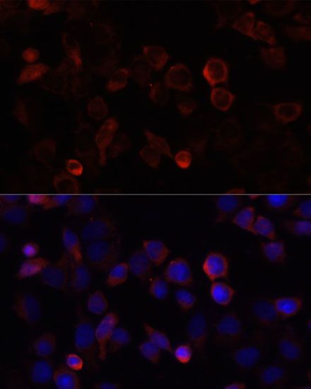 Immunohistochemistry - [KO Validated] S100A4 Polyclonal Antibody (144-01631)