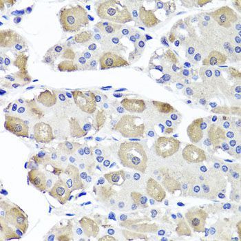Immunohistochemistry - OTC antibody (144-09834)