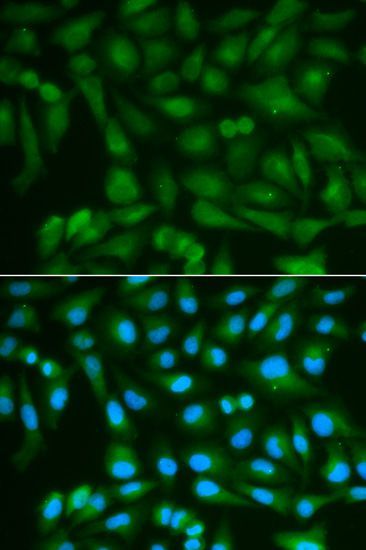 Immunofluorescence - SORD antibody (144-02118)