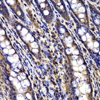 Immunohistochemistry - ARID3A Polyclonal Antibody (144-07668)