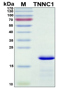 SDS-PAGE