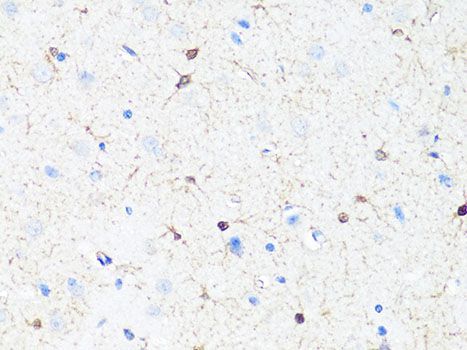 Immunohistochemistry - TH Polyclonal Antibody (144-00028)