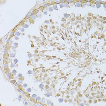 Immunohistochemistry - ENO3 Polyclonal Antibody (144-03852)
