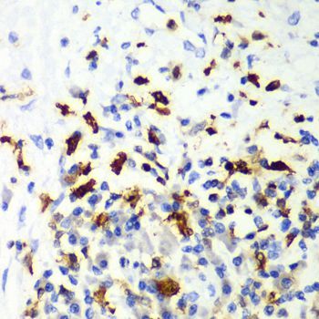 Immunohistochemistry - [KO Validated] CAPG Polyclonal Antibody (144-07324)
