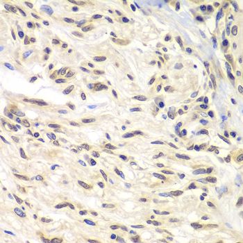 Immunohistochemistry - CHEK1 Polyclonal Antibody (144-07653)