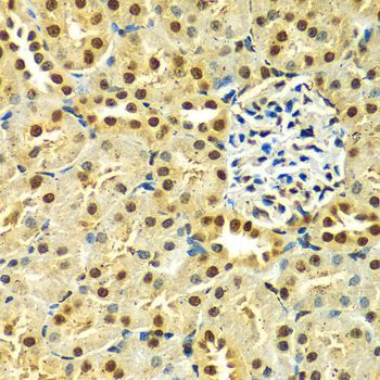 Immunohistochemistry - [KO Validated] HNRNPA2B1 Polyclonal Antibody (144-01162)