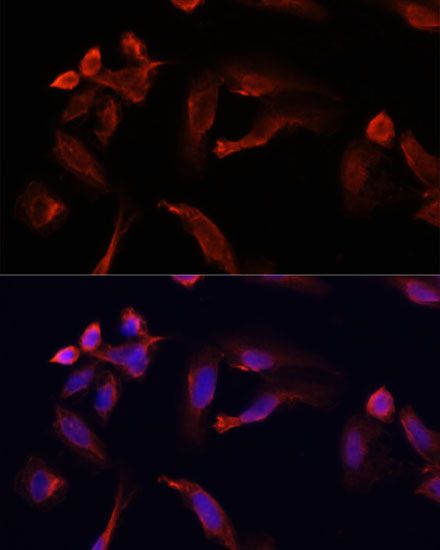 Immunofluorescence - TYMS Polyclonal Antibody (144-010441)