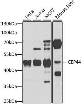 Western blot - CEP44 antibody (144-08317)