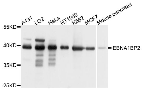 Western blot - EBNA1BP2 antibody (144-09153)
