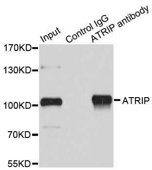 Immunoprecipitation - ATRIP Polyclonal Antibody (144-61409)