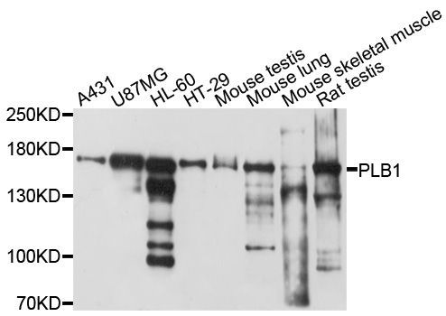 Western blot - PLB1 Polyclonal Antibody (144-10429)