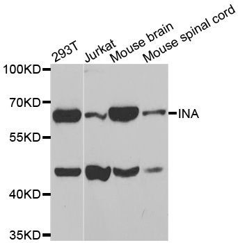 Western blot - INA antibody (144-03109)