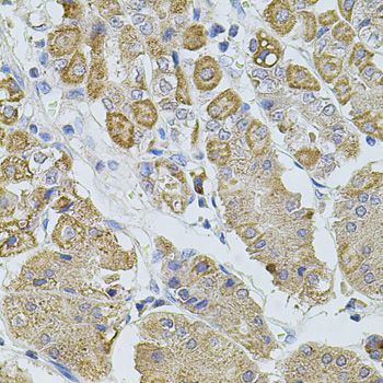 Immunohistochemistry - TRPA1 Polyclonal Antibody (144-08568)