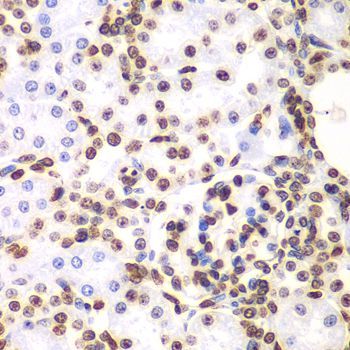 Immunohistochemistry - HIST3H3 antibody (144-61338)