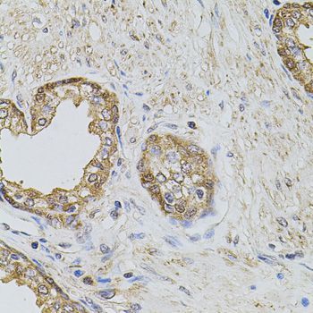 Immunohistochemistry - PLK4 antibody (144-09863)