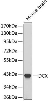 Western blot
