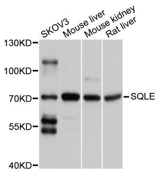 Western blot - SQLE antibody (144-02428)