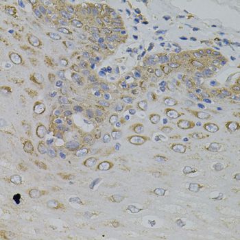 Immunohistochemistry - IRF1 Polyclonal Antibody (144-07692)
