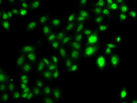 Immunofluorescence - CBFA2T2 antibody (144-07033)