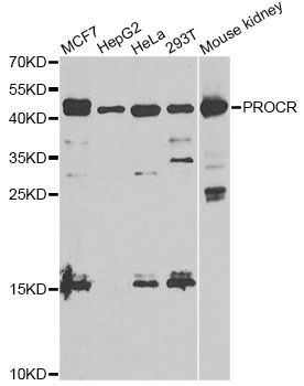 Western blot - PROCR antibody (144-05763)
