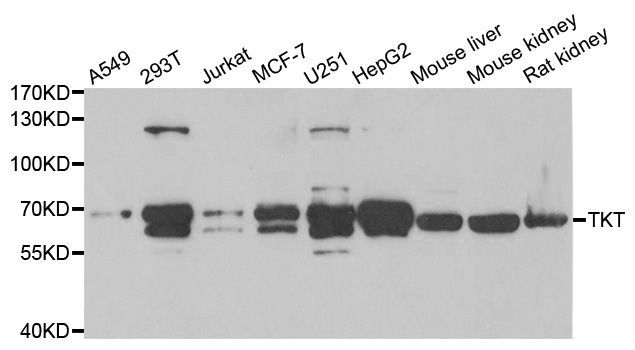 Western blot - TKT antibody (144-06314)