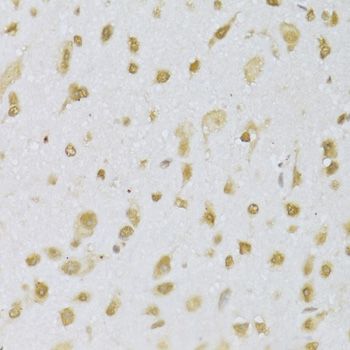 Immunohistochemistry - CBX8 Polyclonal Antibody (144-06222)