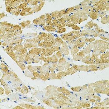 Immunohistochemistry - [KO Validated] RALBP1 Polyclonal Antibody (144-01140)