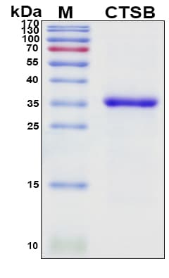 SDS-PAGE Image