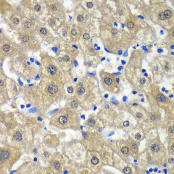 Immunohistochemistry - MAT1A antibody (144-61348)