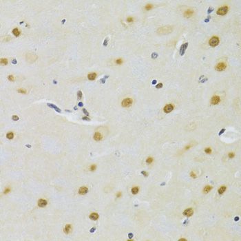 Immunohistochemistry - DDB1 Polyclonal Antibody (144-02896)