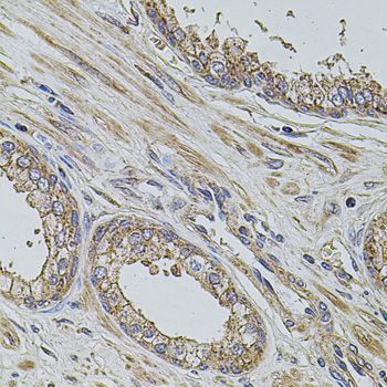 Immunohistochemistry - PDCD6IP antibody (144-02215)