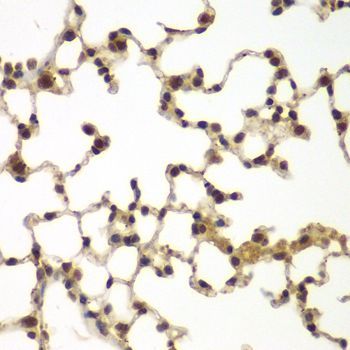 Immunohistochemistry - SULT2B1 antibody (144-07736)