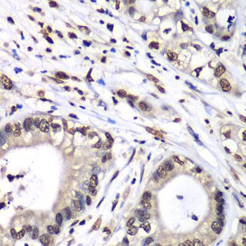 Immunohistochemistry - HNRNPM Polyclonal Antibody (144-06937)