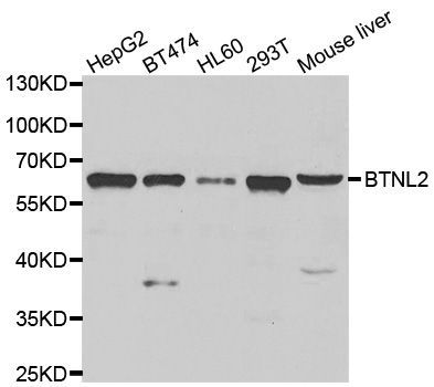 Western blot - BTNL2 antibody (144-07120)