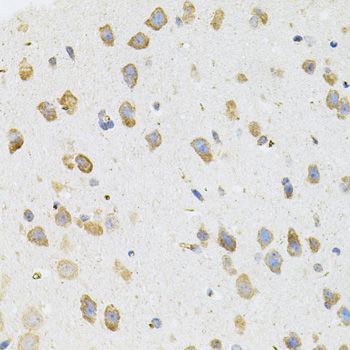 Immunohistochemistry - TGM2 Polyclonal Antibody (144-00981)