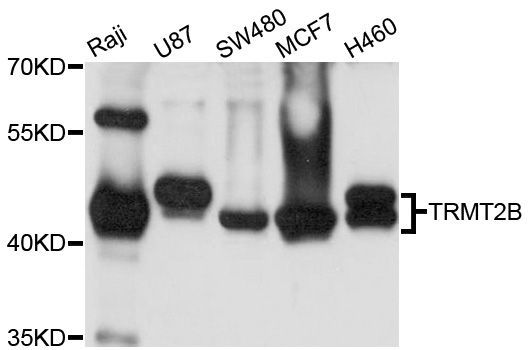 Western blot - TRMT2B antibody (144-03509)