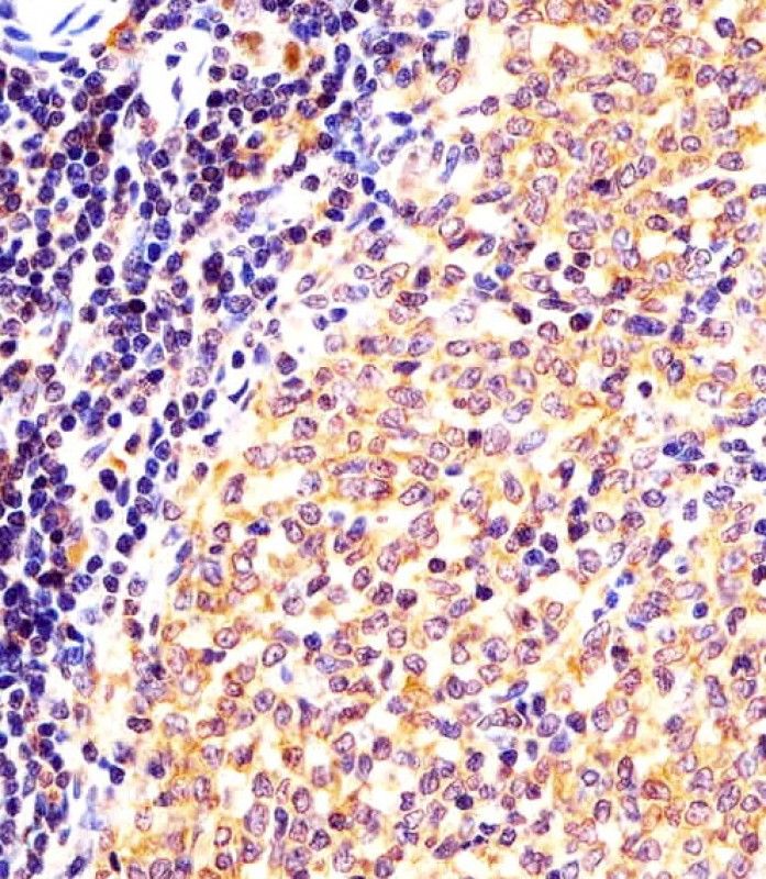 IHC-P