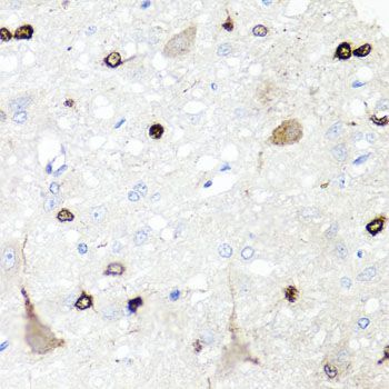 Immunohistochemistry - IGFBP5 antibody (144-012451)