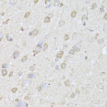 Immunohistochemistry - TRAP1 Antibody (144-02748)