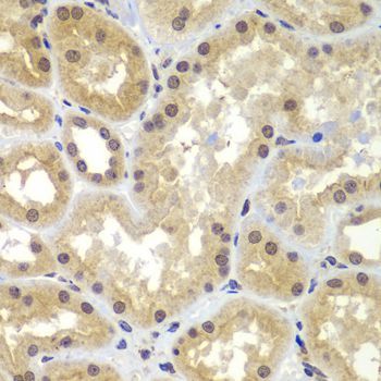 Immunohistochemistry - CEBPG Polyclonal Antibody (144-07279)