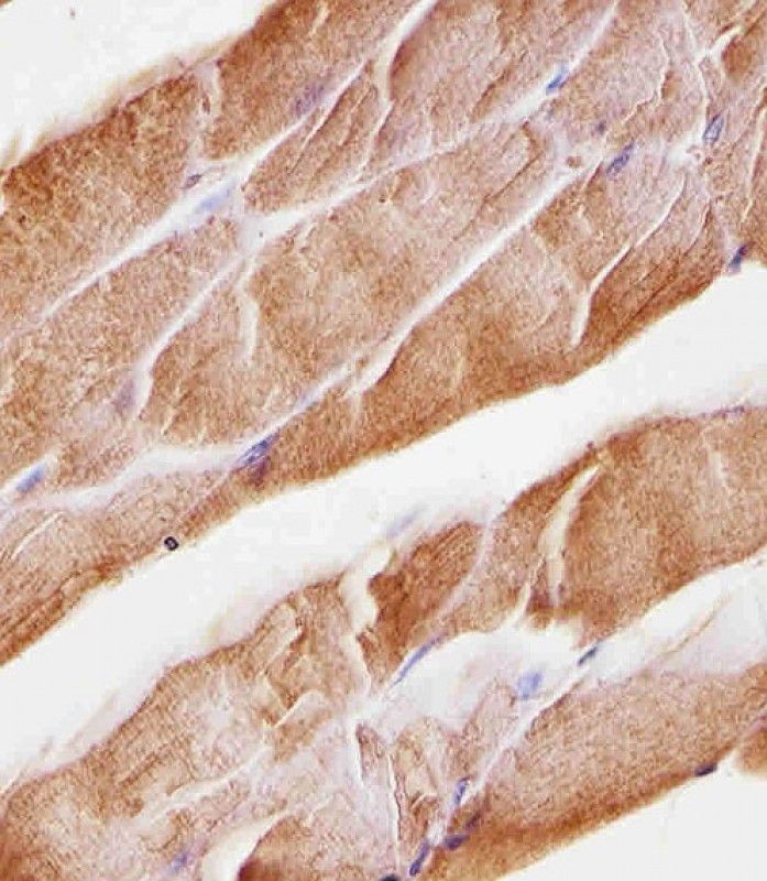 IHC-P