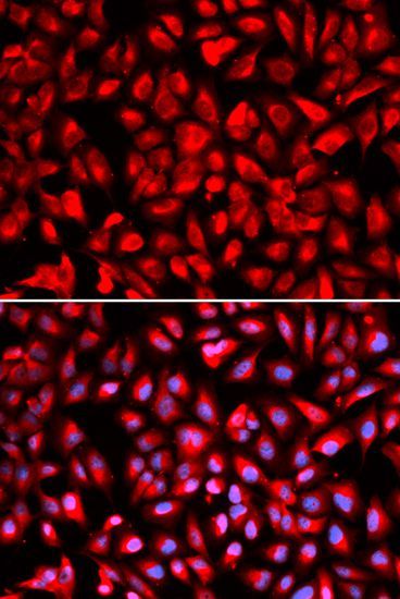 Immunofluorescence - IPO5 Polyclonal Antibody (144-01984)