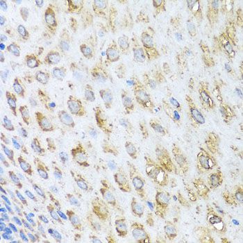Immunohistochemistry - STK4 Polyclonal Antibody (144-08043)