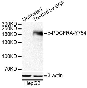 Western blot - Phospho-PDGFRA-Y754 antibody (144-50568)