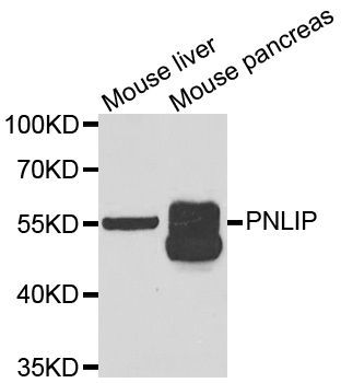 Western blot - PNLIP Polyclonal Antibody (144-06396)